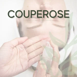 Couperose Treatment