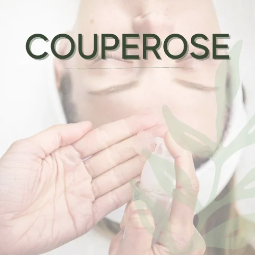 Couperose Treatment